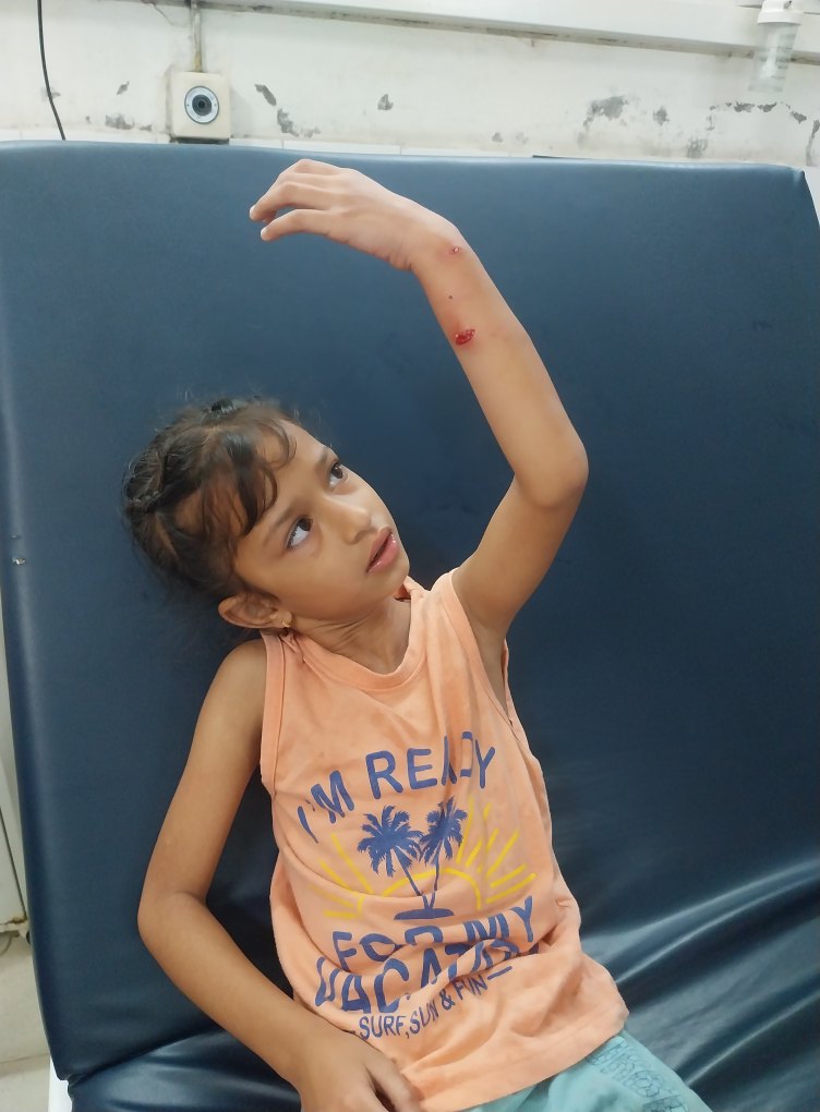 Monkey terror in Garhshankar area, many children injured.
